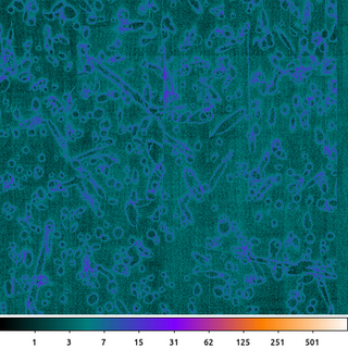 filter.nonlinear.mean.stack